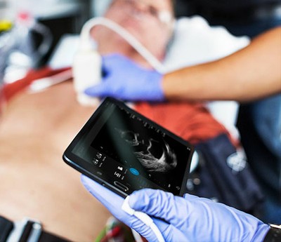 Aparelho portátil de ultrassom conectado a celular