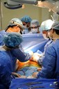 Transplante de fígado Transplante de fígado